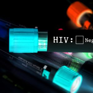 安全研究员发现HIV交友app漏洞，反被厂商用艾滋病威胁